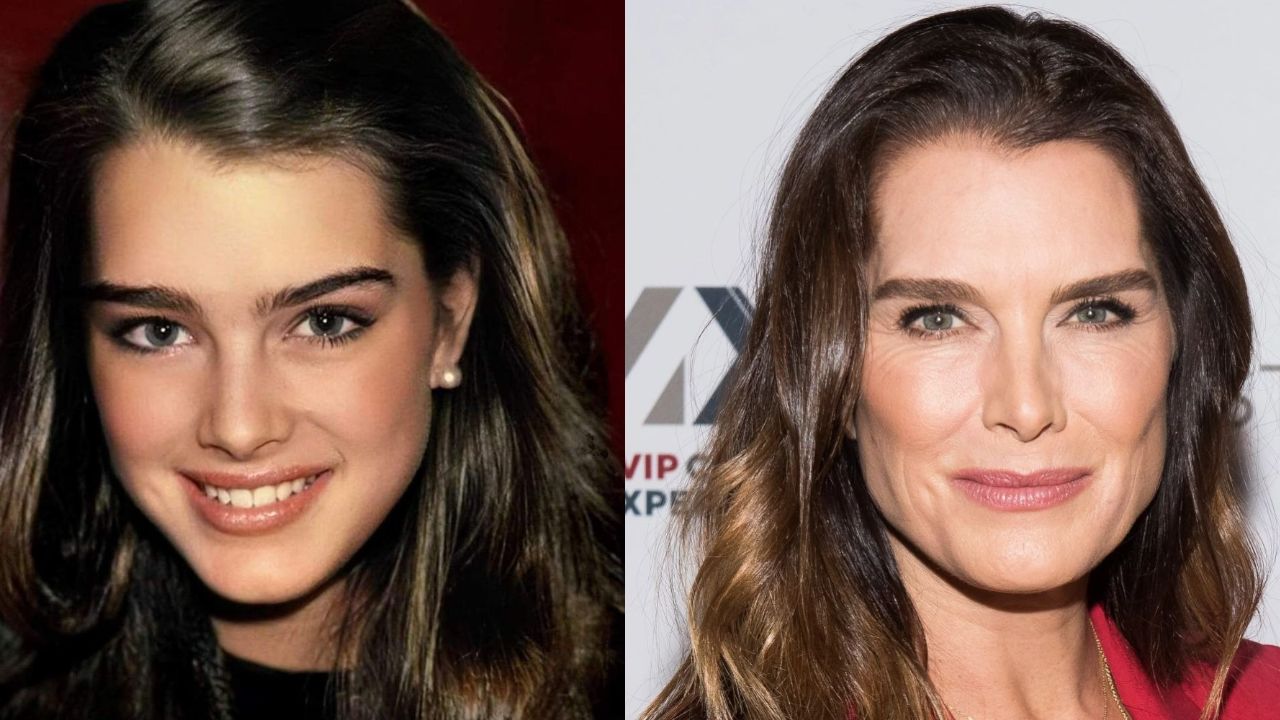 Brooke shields plastic surgery