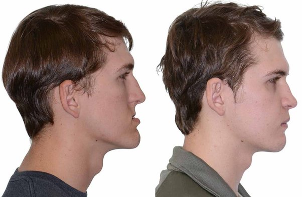 Main qimg 1f07f3b178986b11cd028144bbee6cf1 lq