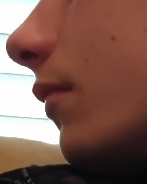 Jaw
