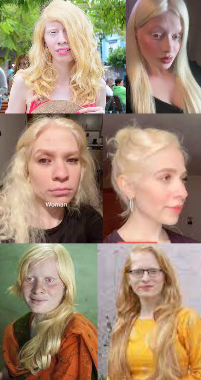 Albino women races