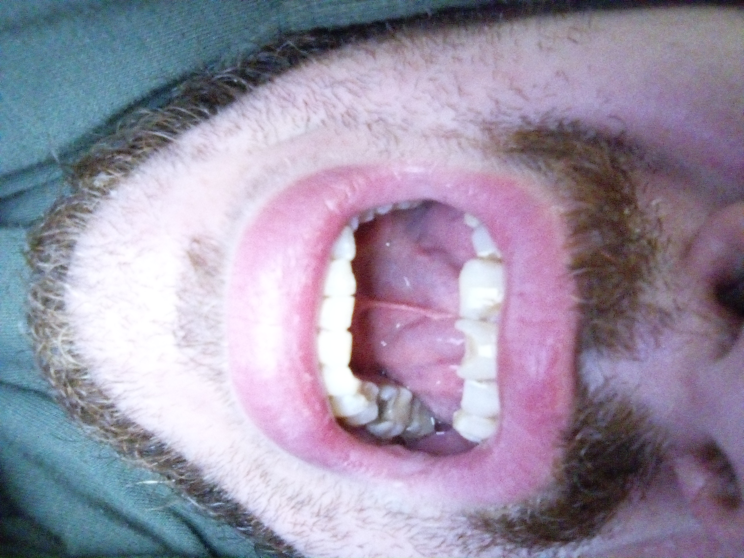 IMG 20231111 105511