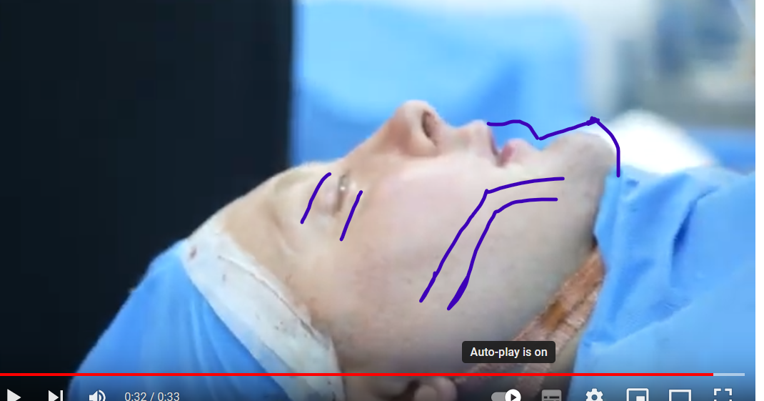 1699796884299