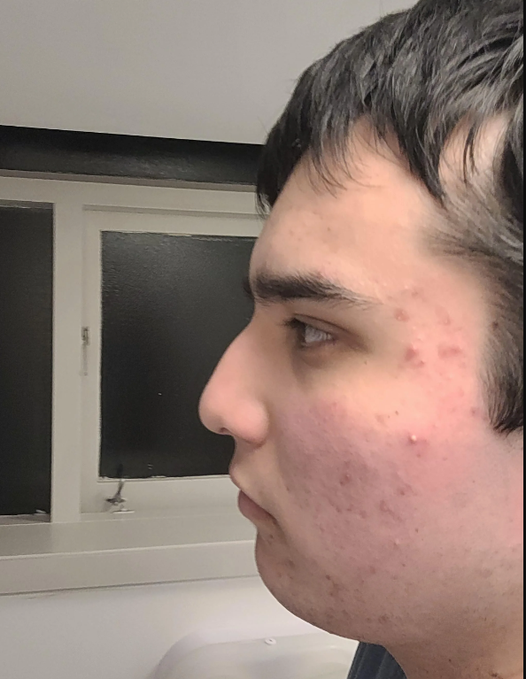 Sideproff