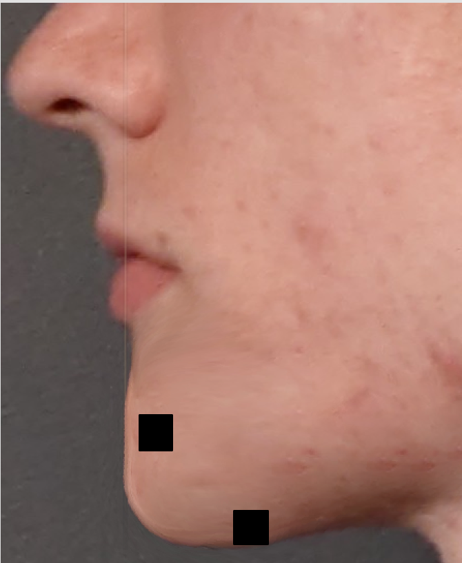 1700071182326