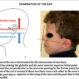 Clinical examination of the nose Q320