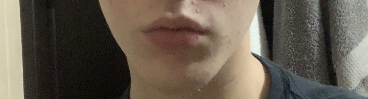 IMG 0600