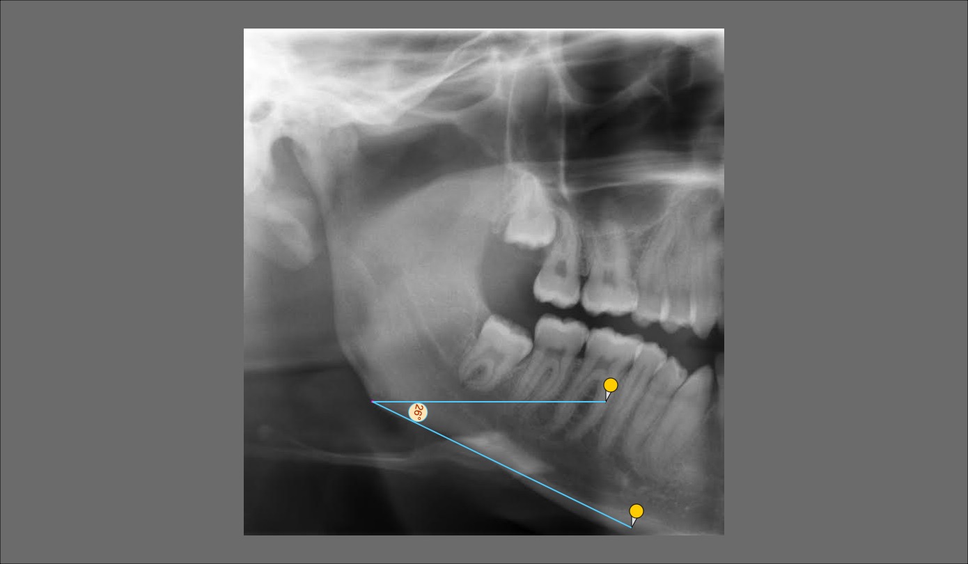 Ginifab protractor 20231118152946