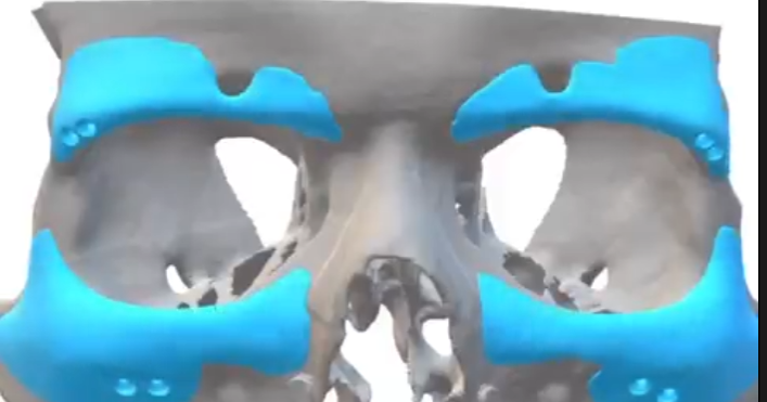 1700410331482