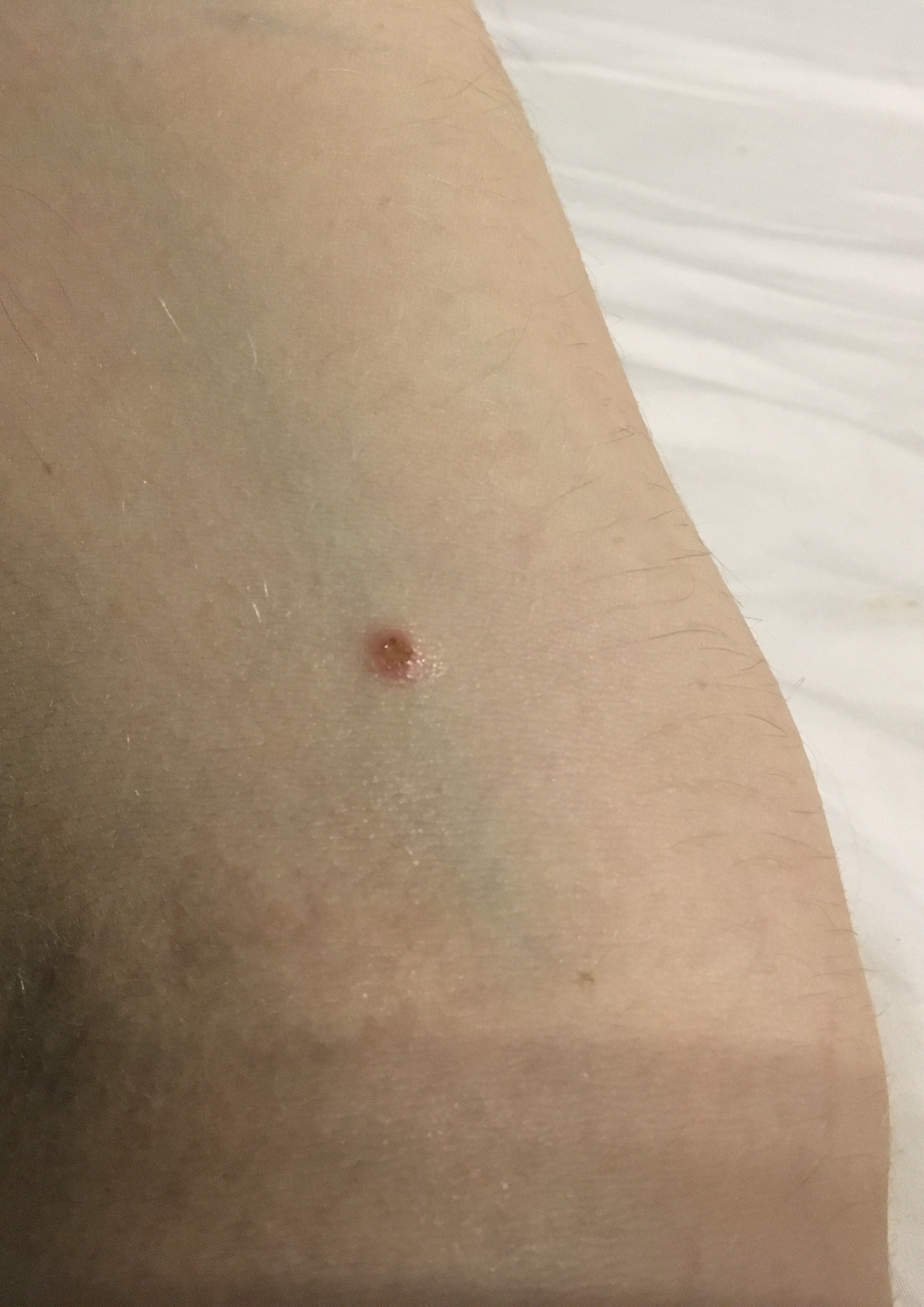 902F033D 1D22 41AD B5EB 4CF11711EDE4