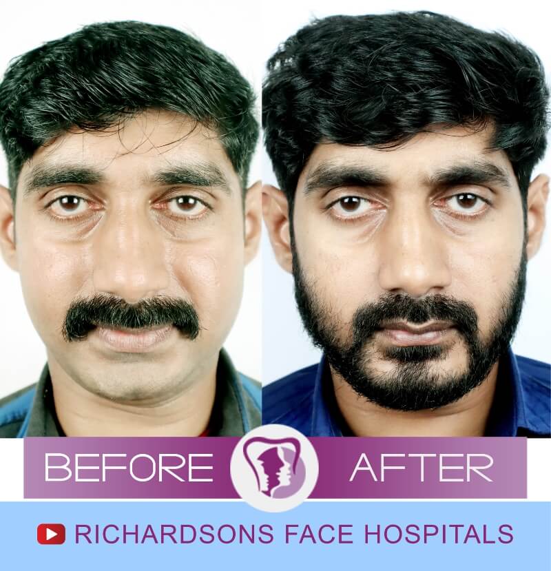 Prajith Orthognathic Surgery