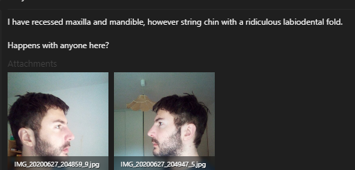 1700864981613