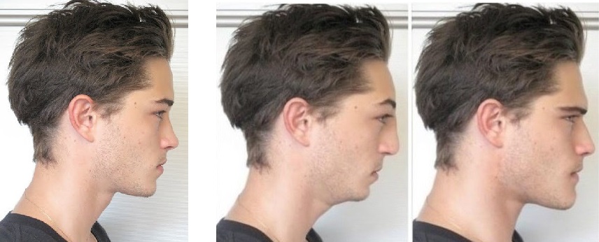 3784331 forward growth