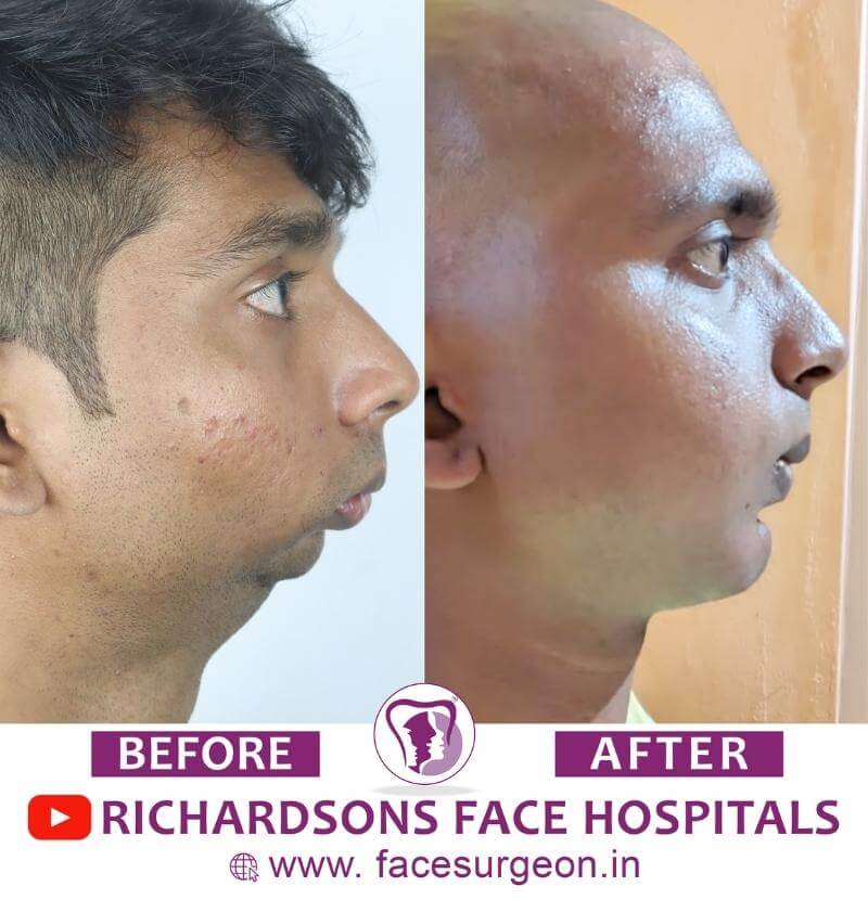 1701023493717