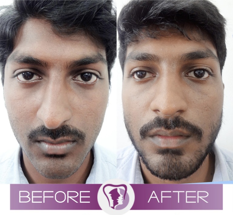 F9C9FCF9 457A 417F 9AD4 BB0C82D5626A F9C9FCF9 457A 417F 9AD4 BB0C82D5626A