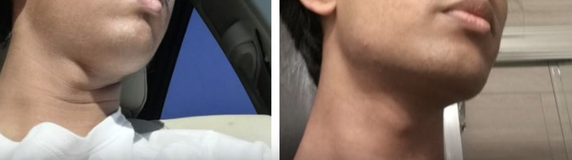 1701317418721
