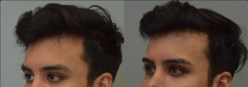 1701542037746