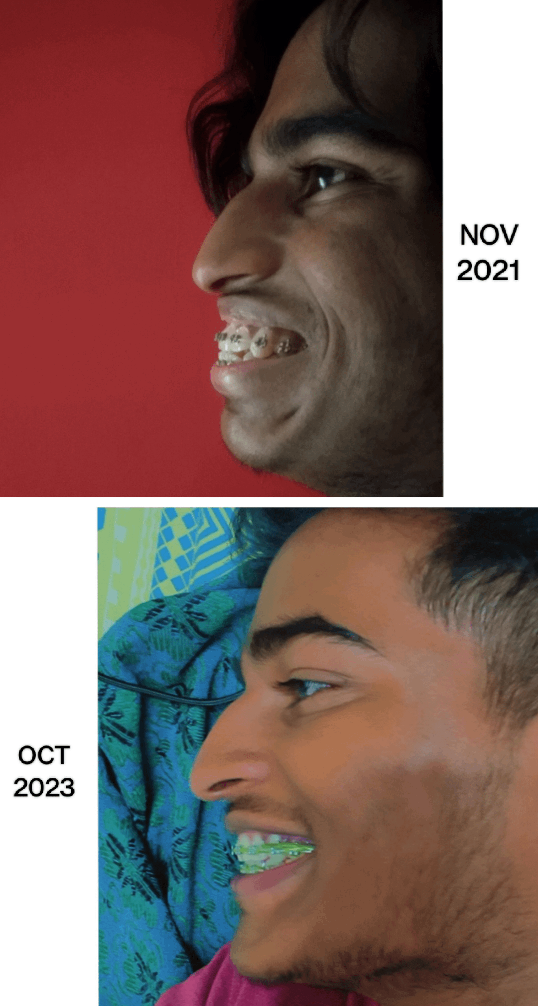2 years of progress v0 526ui768qrtb1