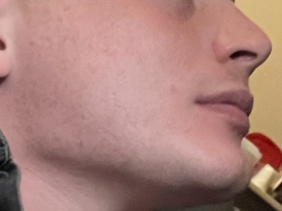 IMG 2399