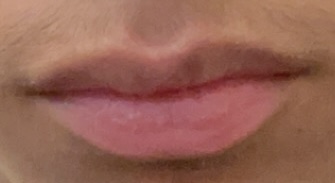 IMG 3542