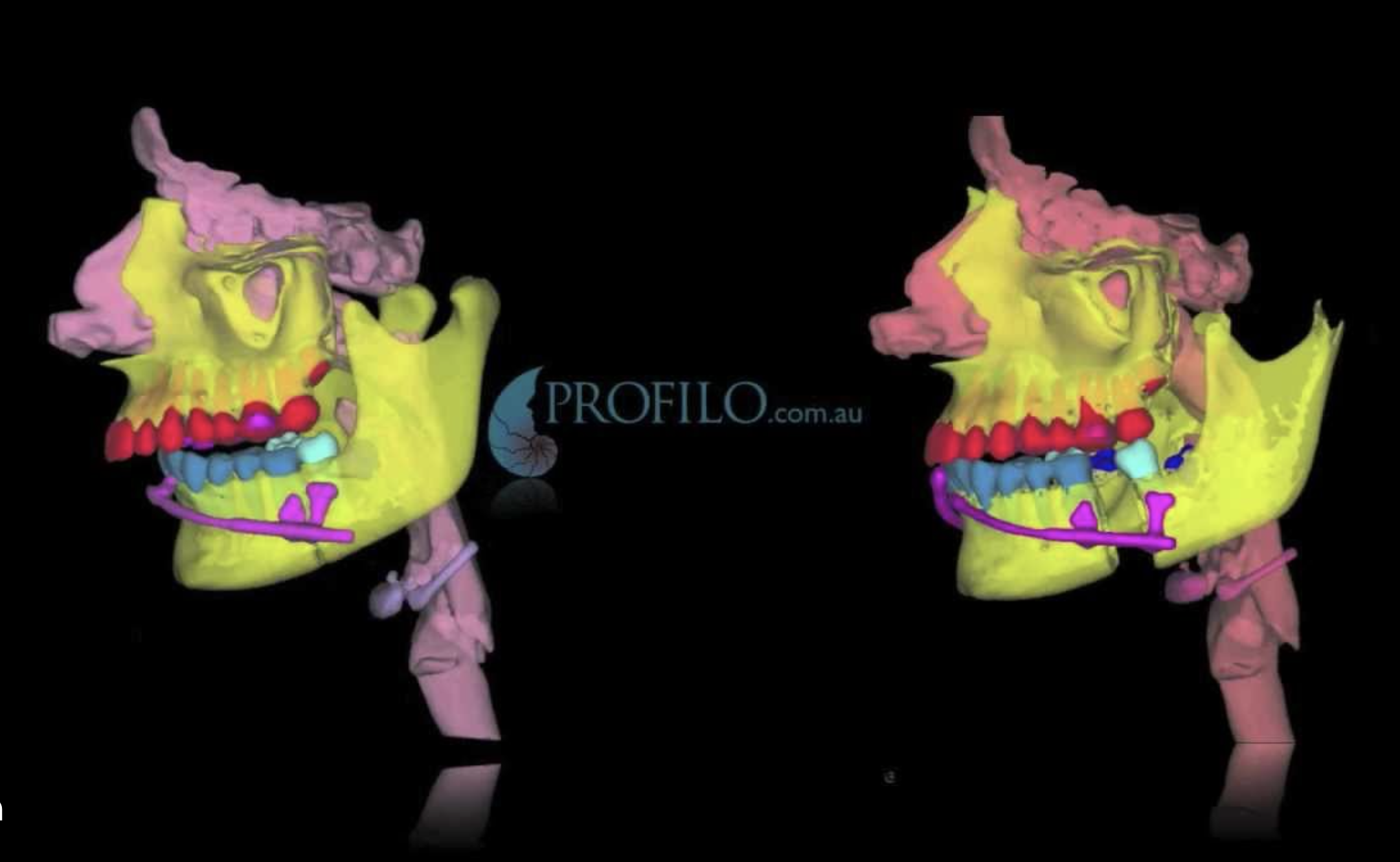 Screenshot 2023 12 06 at 92900PM