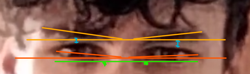 Eye area analysis Eye area analysis