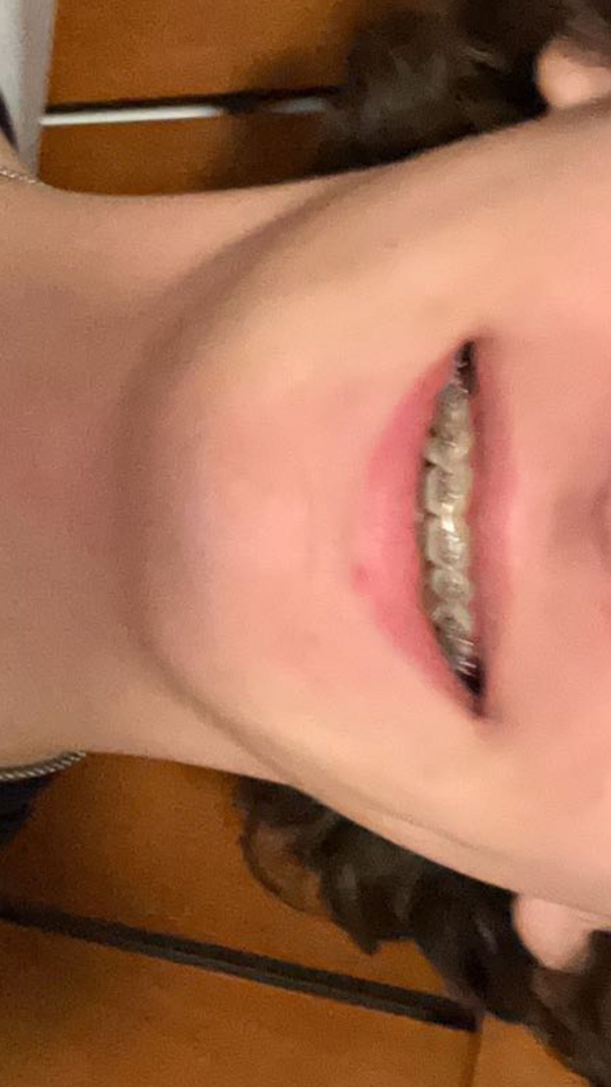 IMG 1854