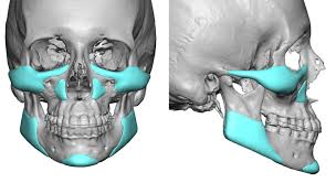 Download 5