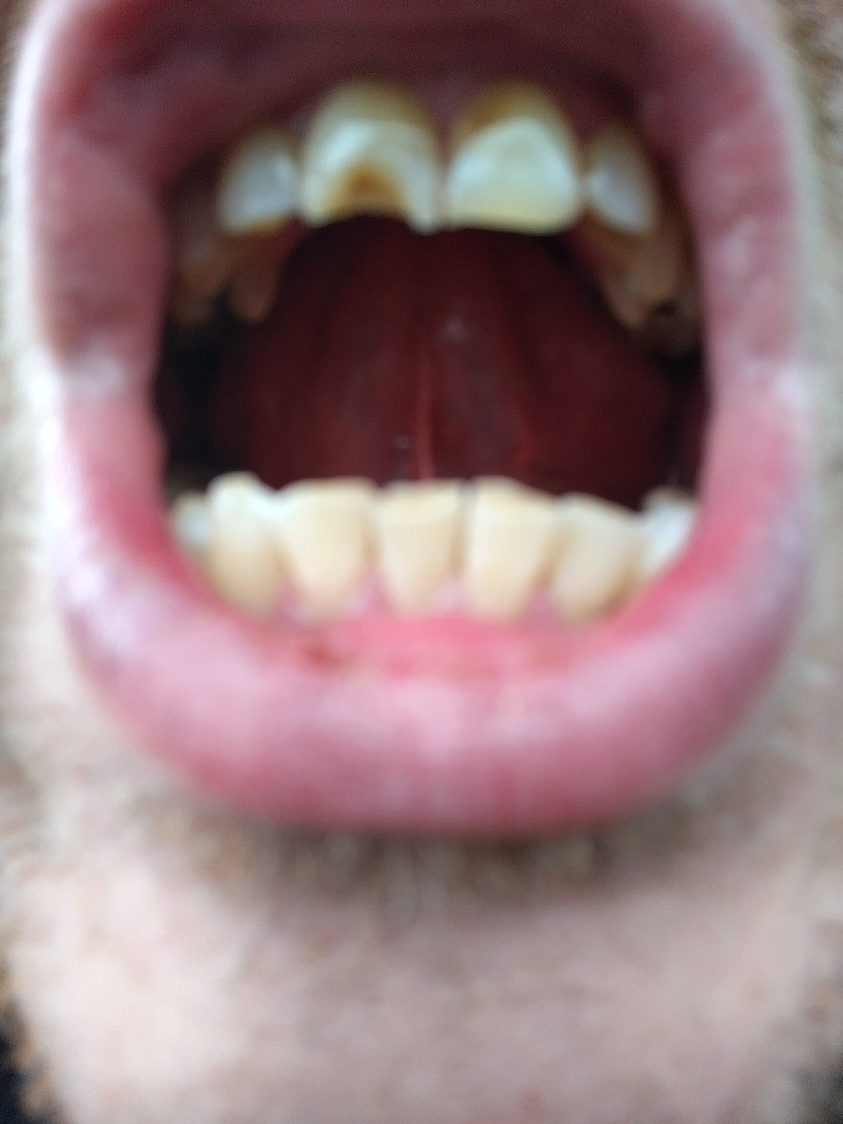 IMG 20231211 155453 HDR