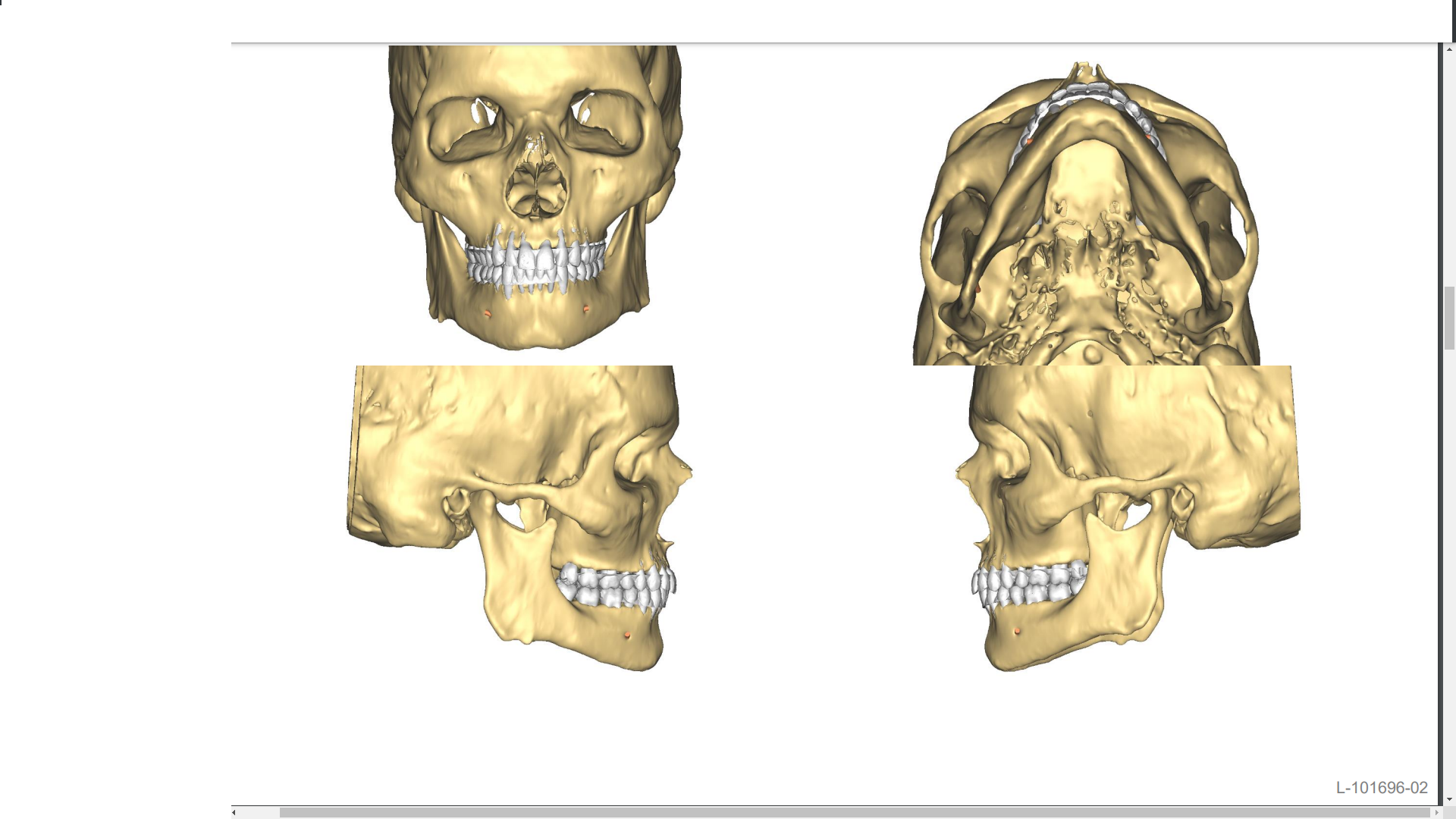 Ct scan 1 bis