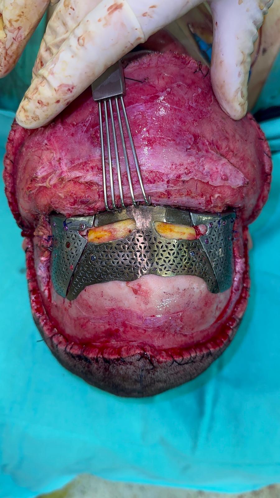 3821803 3821636 393647a2 8427 406c 8b15 14b20bc67521