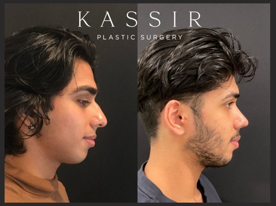 Captura de pantalla 2023 12 17 111128