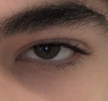 1000005028