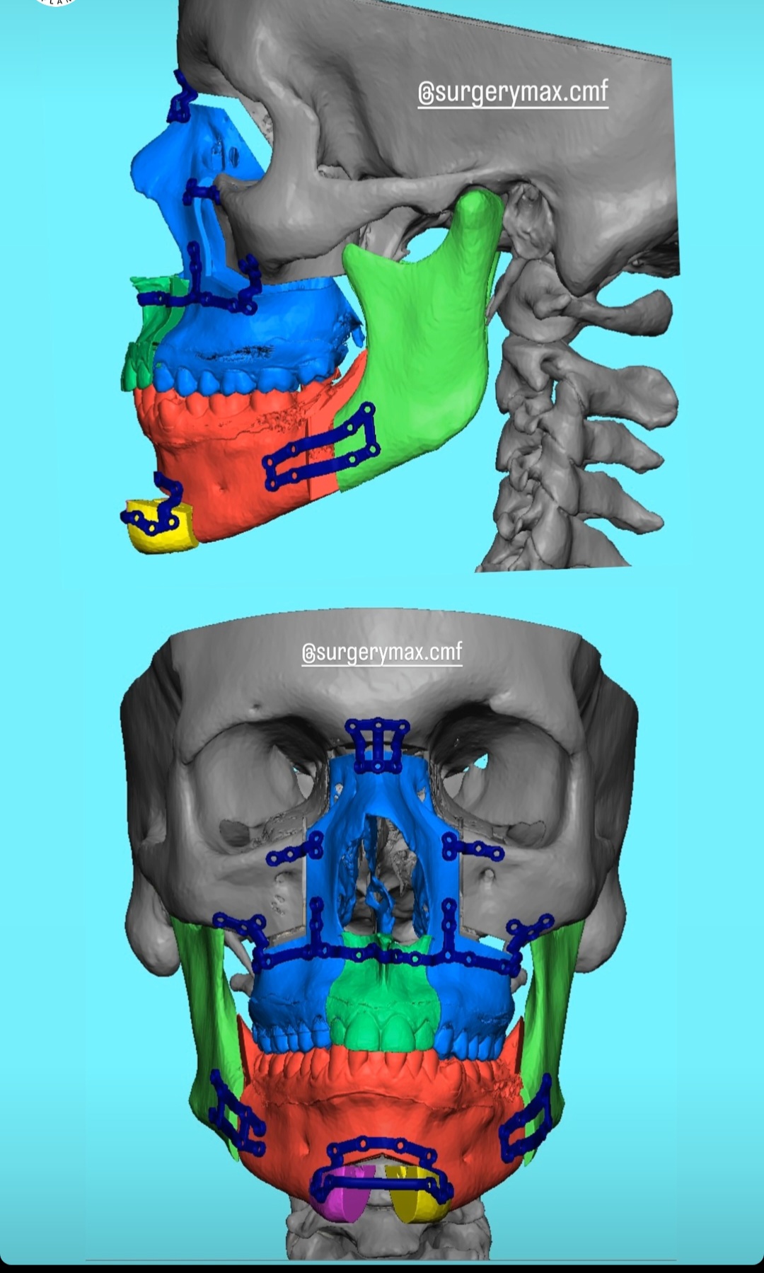 Screenshot 20231221 080114 Instagram