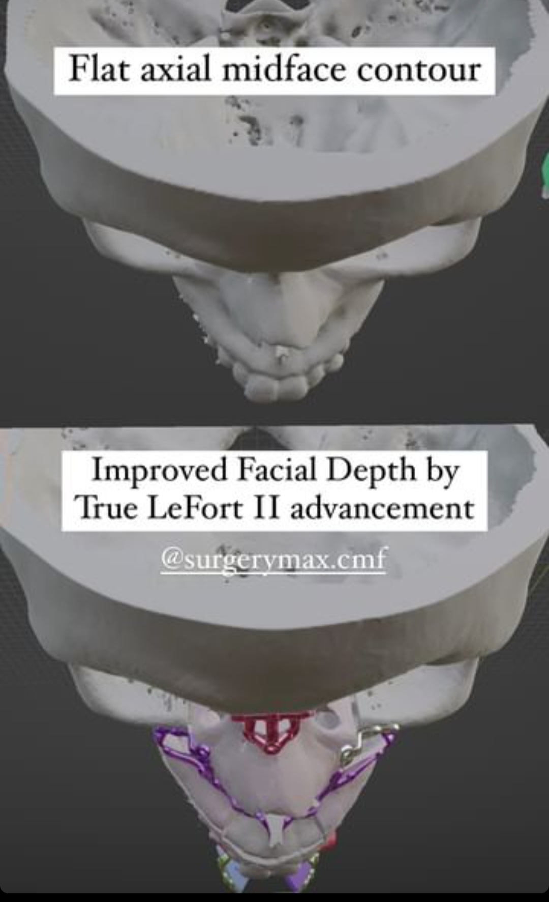 Screenshot 20231221 080123 Instagram