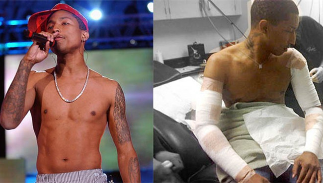 14 Celebrities Who Utilized Tattoo Removal Services Image 4