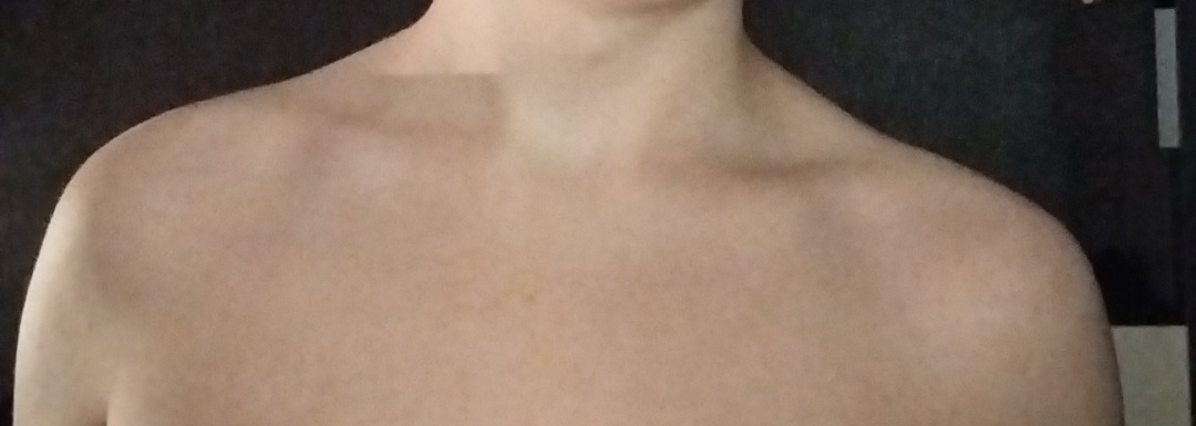 1000102688 02