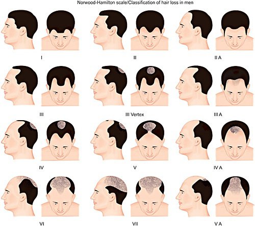 Main qimg 9d17283fe0b1da9cdaa19511ad6ebad3 lq