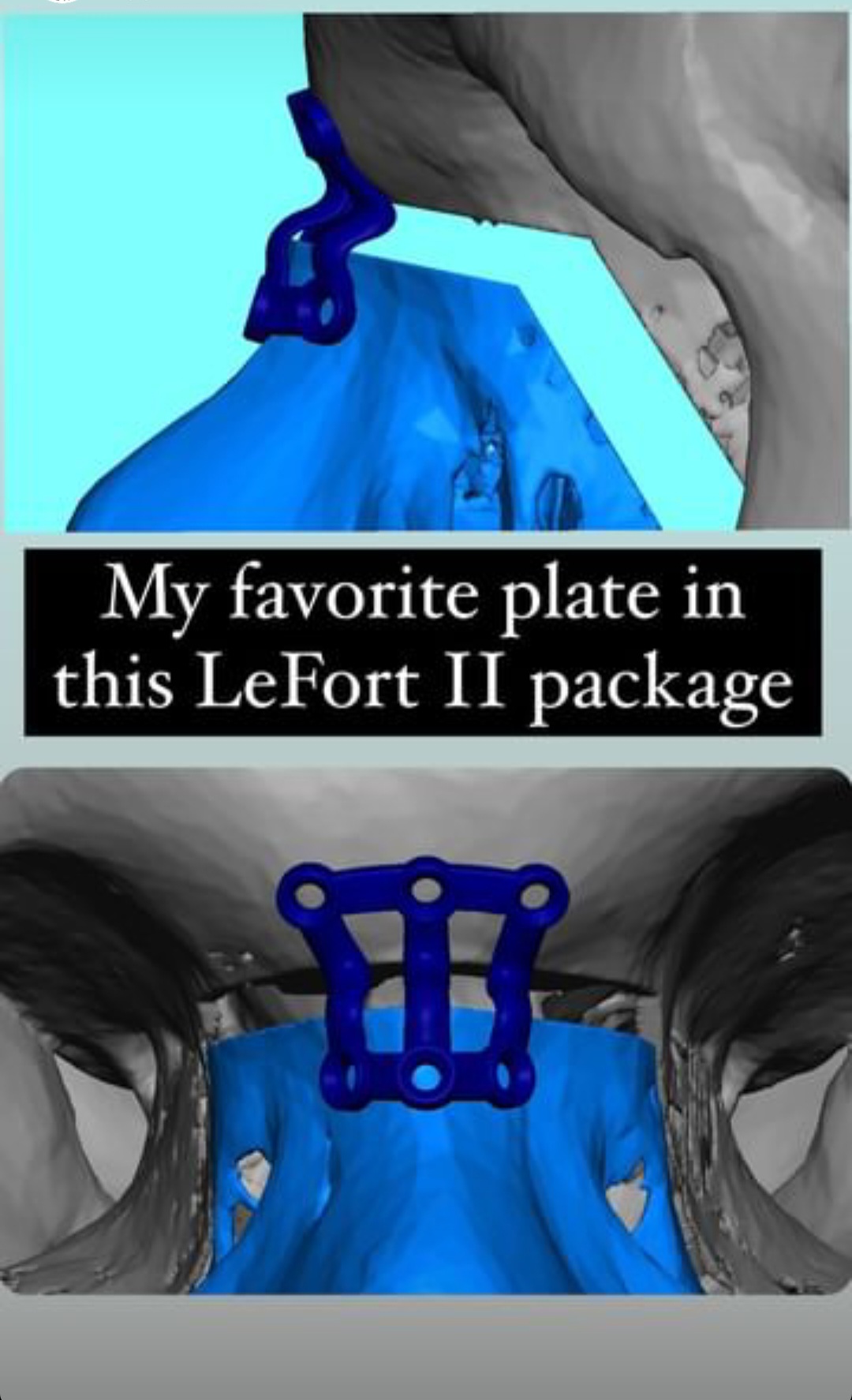 Screenshot 20231221 080119 Instagram