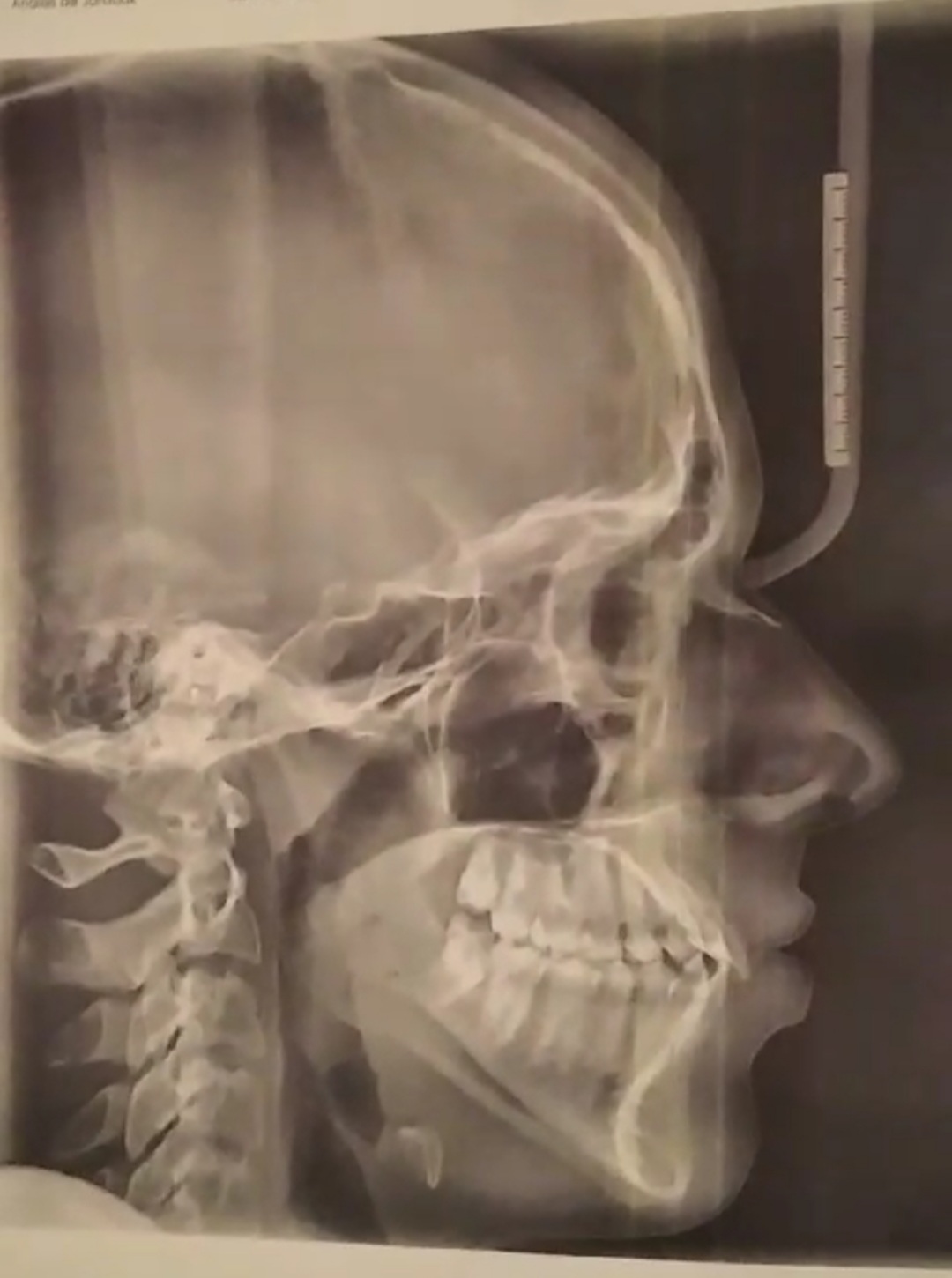 Screenshot 20231227 211937 Gallery