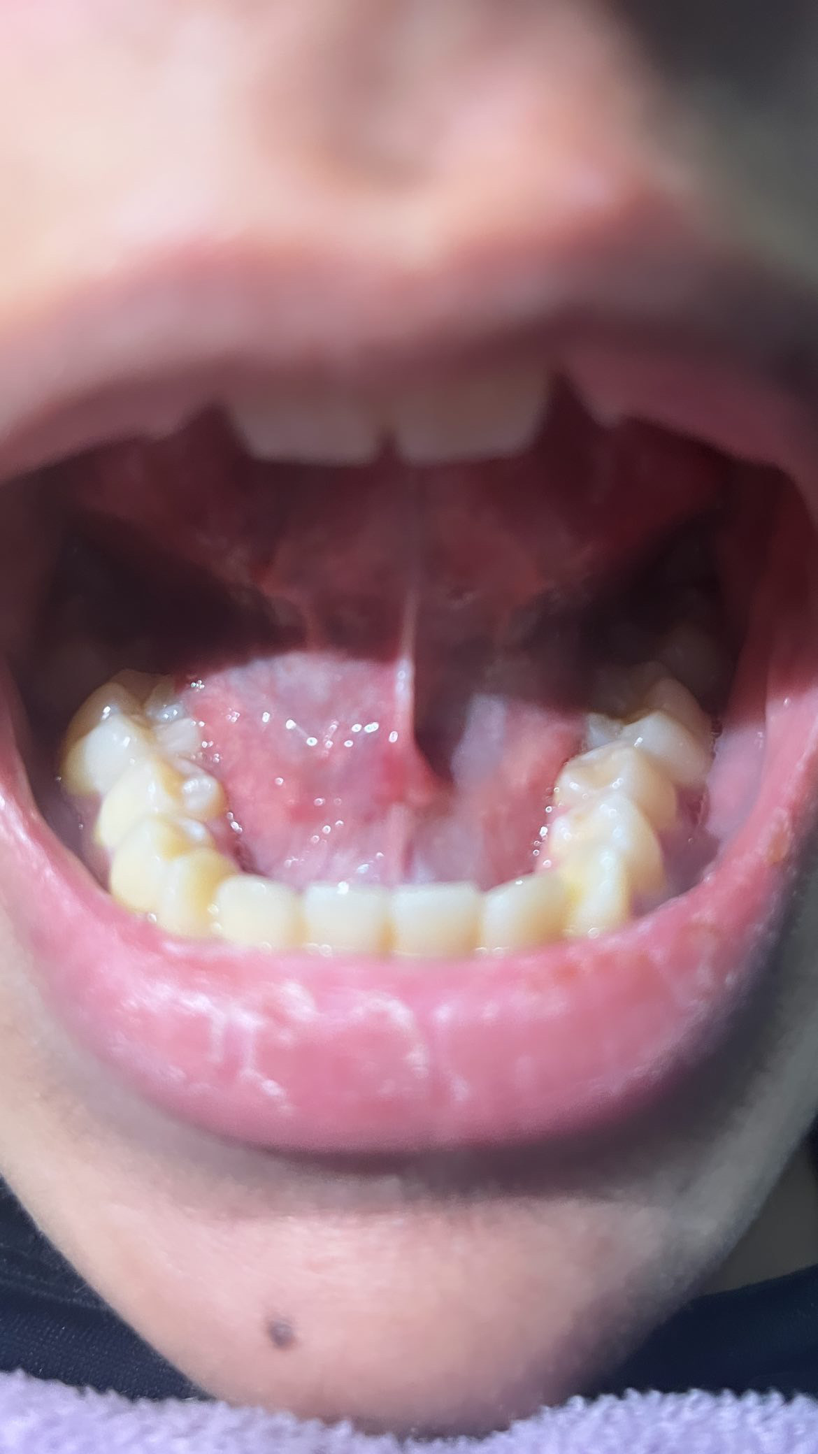 A2FC13C1 9654 43F3 A737 DBFA00C36B73