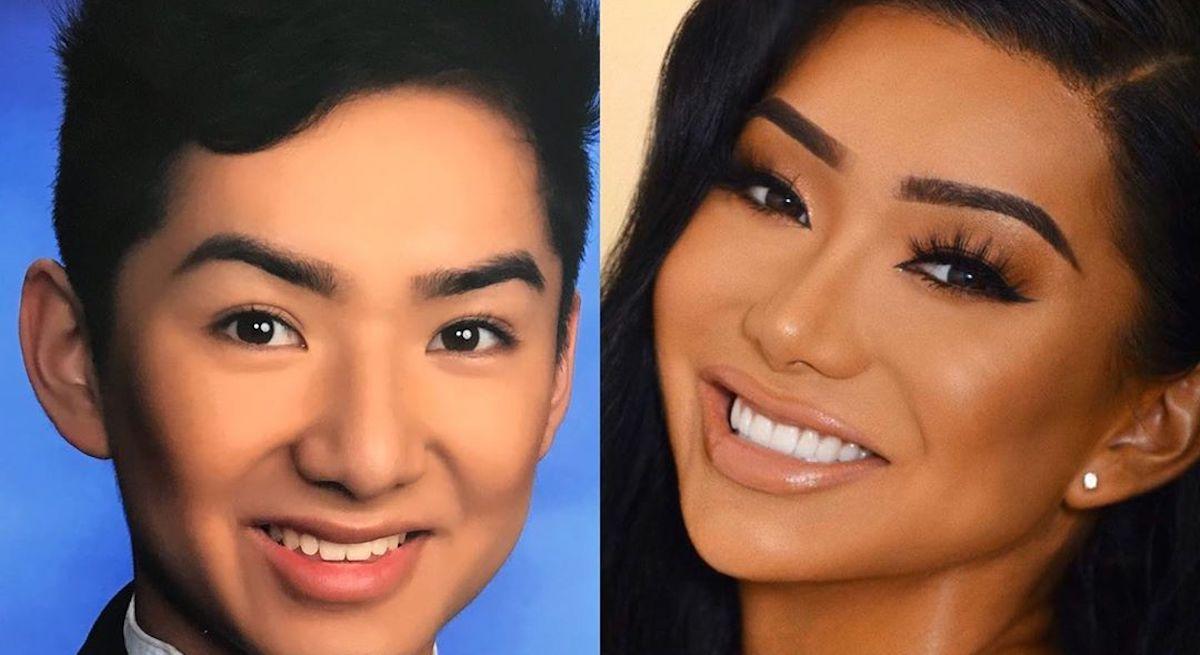 Nikita dragun plastic surgery before after 1589390141386