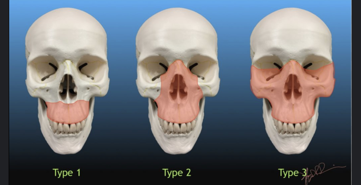 19A500F8 A879 48E1 95B2 5349CA1D4769