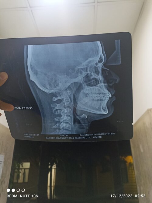 cephalogram.jpg