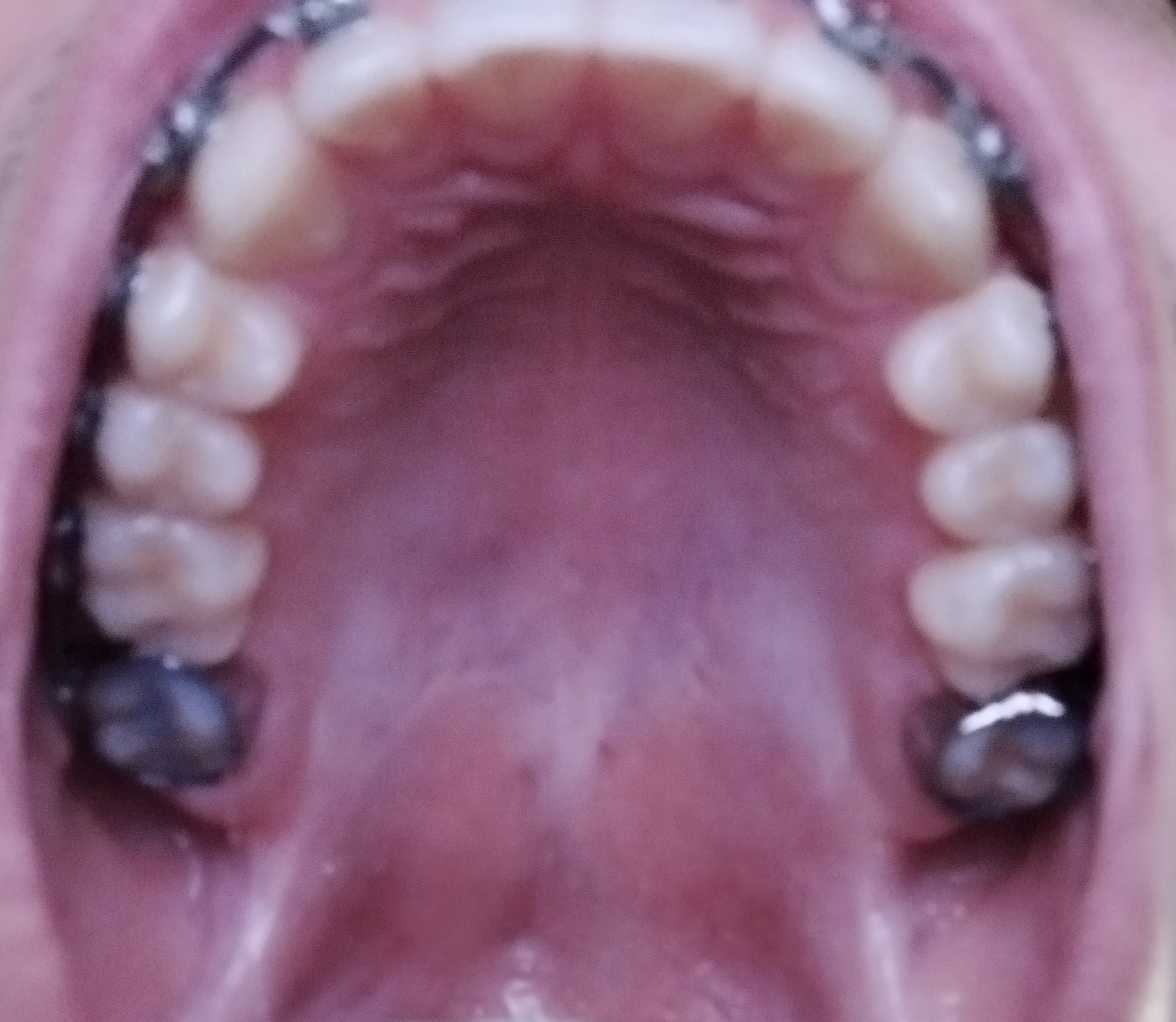 IMG 20240105 223017