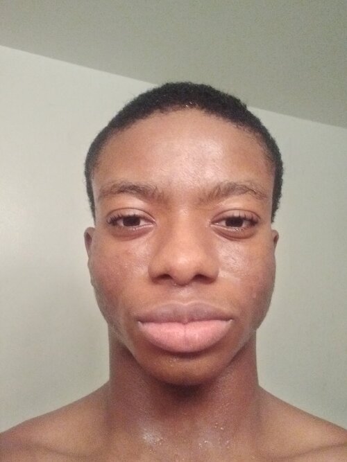 Black truecel