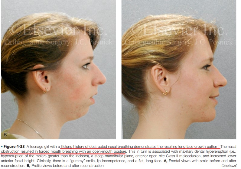 Jc posnick mouthposture case1