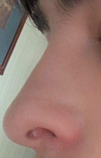 1000006733