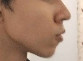 1705335915808