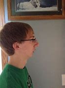 Image result for chinless kid