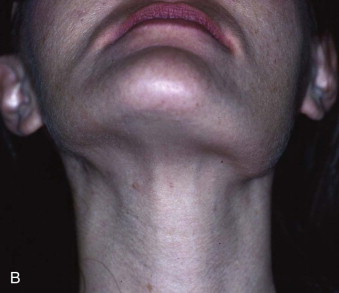 F080 001b 9781416025276